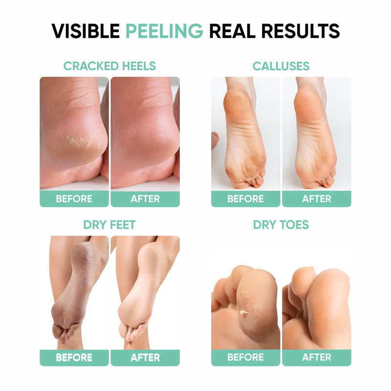 Foot Peel Mask