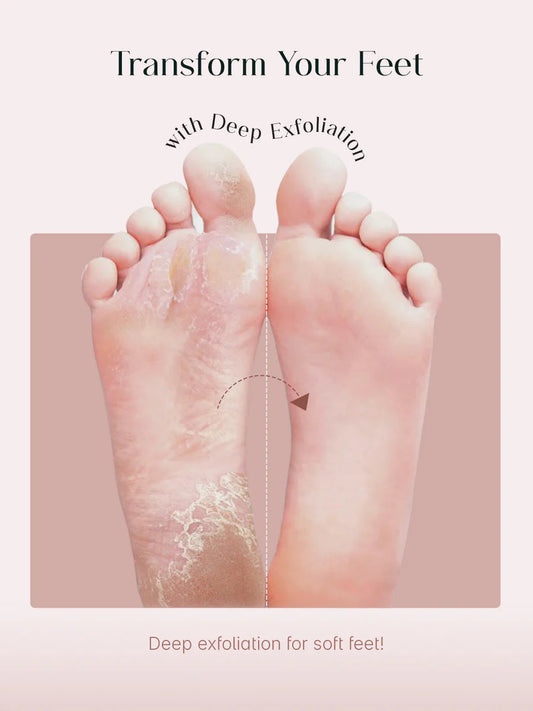Foot Peel Mask