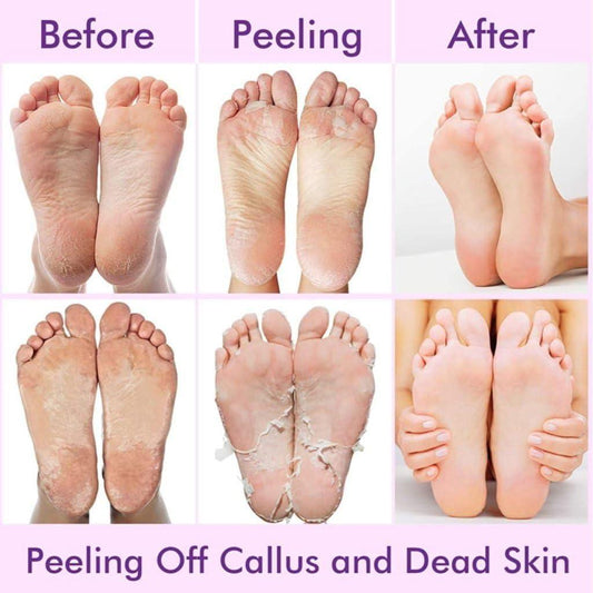 Foot Peel Mask